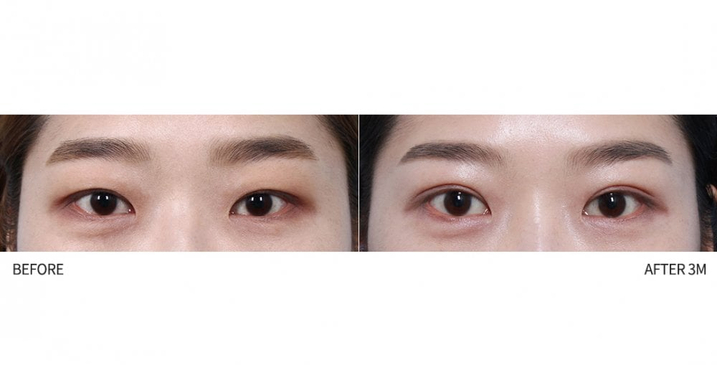 Slider image (4) 1mm Plastic Surgery